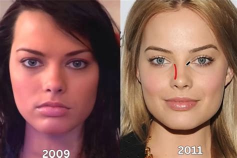 How many plastic surgeries did Margot Robbie get done to look。